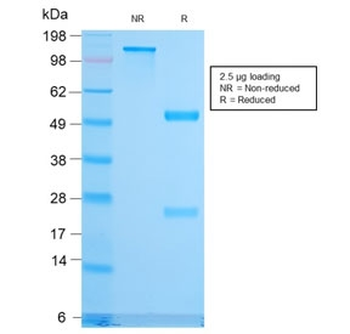 Recombinant CD79b Antibody