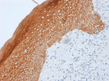 Cytokeratin 5/6/18 Antibody