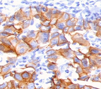 NRG1 Antibody / Neuregulin-1