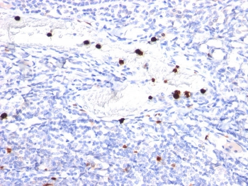 Cystatin A Antibody / CSTA