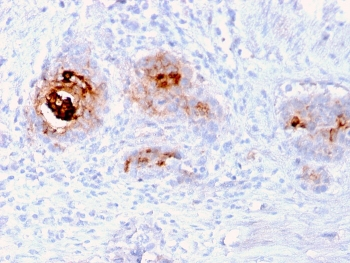 Recombinant TAG-72 Antibody