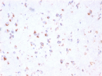 FCGRT Antibody / FcRn
