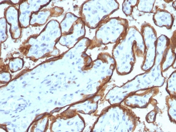 EGFR Antibody / EGF Receptor