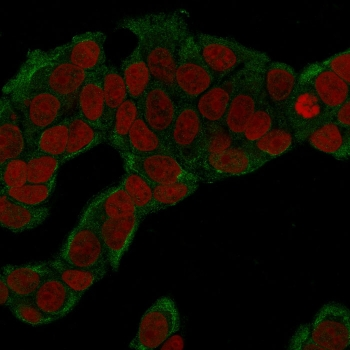 Glucose 6-Phosphate Isomerase Antibody / GPI