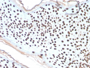 Recombinant Histone H1 Antibody