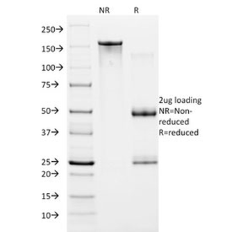 HIF1 alpha Antibody / HIF1A