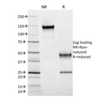 HLA-DRB1 Antibody