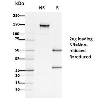 Adenomatous polyposis coli Antibody / APC
