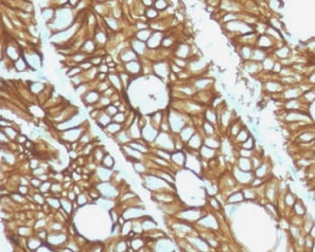 CDH17 Antibody / Cadherin 17