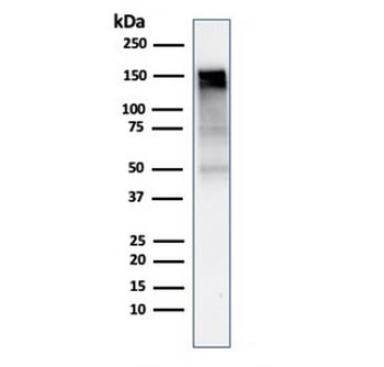 EGFR Antibody / EGF Receptor
