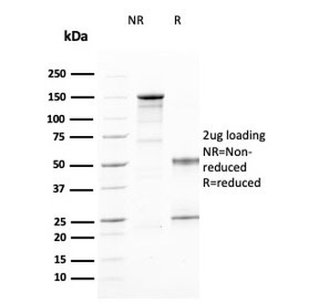 CD25 Antibody