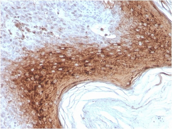 Recombinant Involucrin Antibody