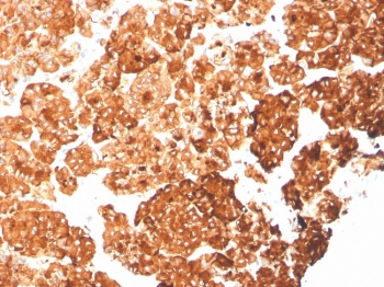 Recombinant Cytokeratin 6A Antibody