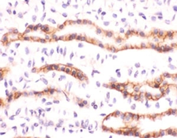 Recombinant Erythropoietin Antibody / EPO