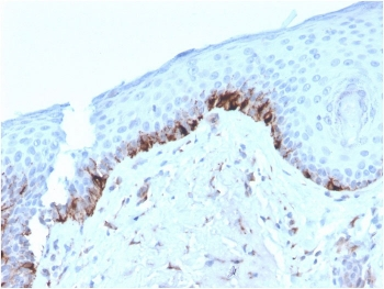 TRP1 / Tyrosinase-Related Protein-1 Antibody / TYRP1
