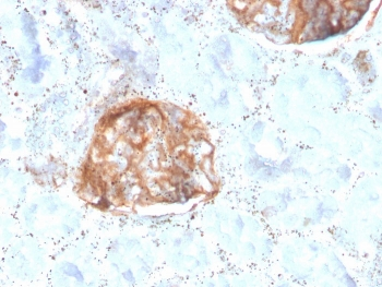 Recombinant MTAP Antibody / S-methyl-5'-thioadenosine phosphorylase