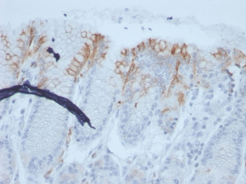Recombinant MUC2 Antibody / Mucin 2