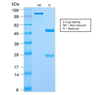 Recombinant c-Myc Antibody