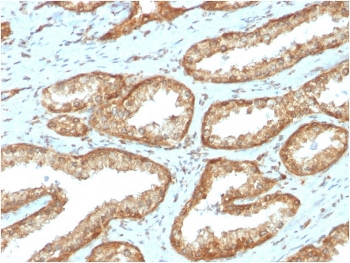 Recombinant YB-1 Antibody