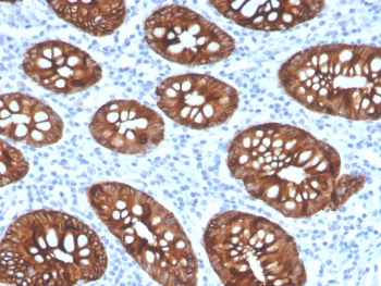 Recombinant Cytokeratin 8 Antibody / Rabbit Monoclonal