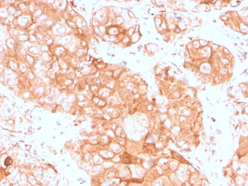 Recombinant Prolactin Receptor Antibody / PRLR