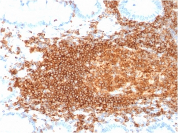 Recombinant CD45RB Antibody