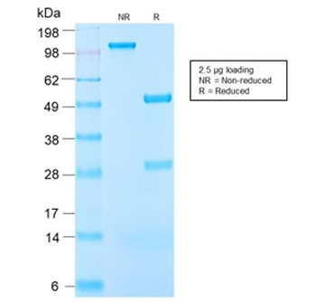 Recombinant Insulin-like Growth Factor 1 Antibody / IGF-1