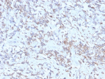 Recombinant RBP-1 Antibody / Retinol Binding Protein 1
