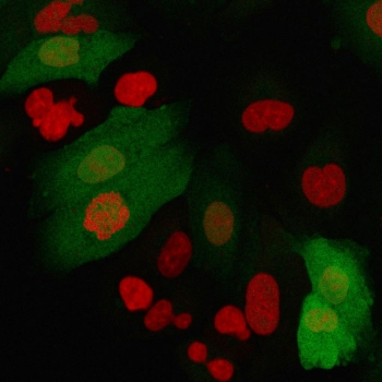 Recombinant FSP1 Antibody / S100A4