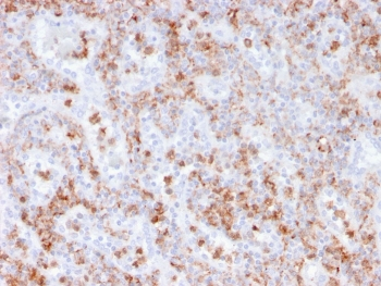 Recombinant S100A9 Antibody / MRP14 / Calgranulin B / Calprotectin