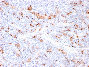 Recombinant S100A9 + Calprotectin Antibody