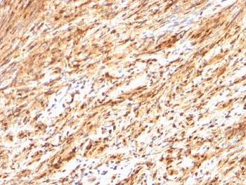 S100B Antibody