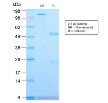 Recombinant CD71 Antibody / Transferrin Receptor / TFRC (Extracellular domain)