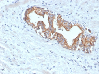 Recombinant AMACR Antibody / p504S