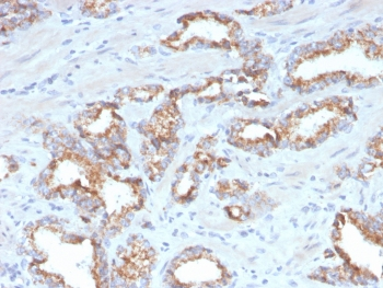 Recombinant AMACR Antibody / p504S