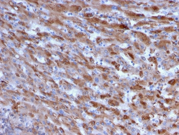 C1QA Antibody / Complement C1q A-Chain