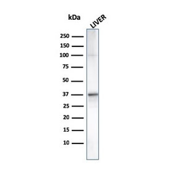 C1QA Antibody / Complement C1q A-Chain