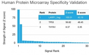 p53 Antibody / TP53