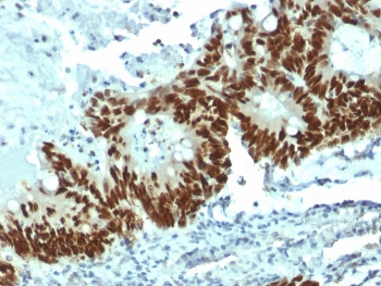 p53 Antibody / TP53