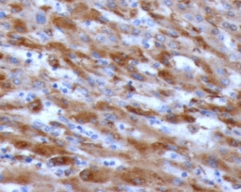 C1QA Antibody / Complement C1q A-Chain
