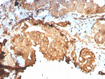 Recombinant GRP94 Antibody / HSP90B1