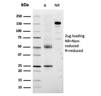 Tyrosinase-Related Protein-1 Antibody / TRP1 / TYRP1