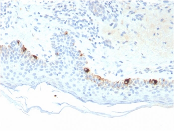 Tyrosinase-Related Protein-1 Antibody / TRP1 / TYRP1