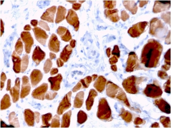 Actinin Alpha 2 Antibody / Sarcomeric Alpha Actinin / ACTN2