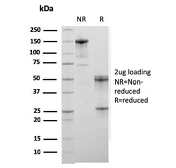 Actinin Alpha 2 Antibody / Sarcomeric Alpha Actinin / ACTN2