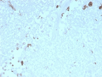 Recombinant ATG5 Antibody