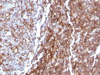 Recombinant CD44 Antibody / HCAM