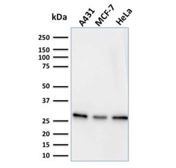 Myofibroblast Antibody