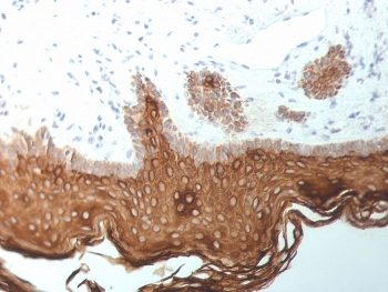 Cytokeratin 5/6/18 Antibody