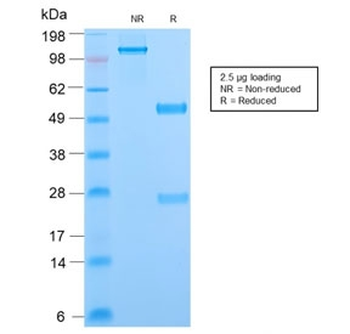Recombinant Phosphotyrosine Antibody / P-Tyr